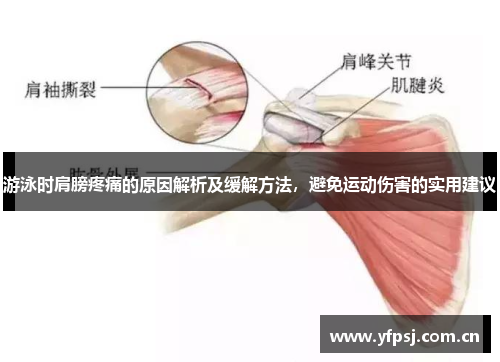 游泳时肩膀疼痛的原因解析及缓解方法，避免运动伤害的实用建议